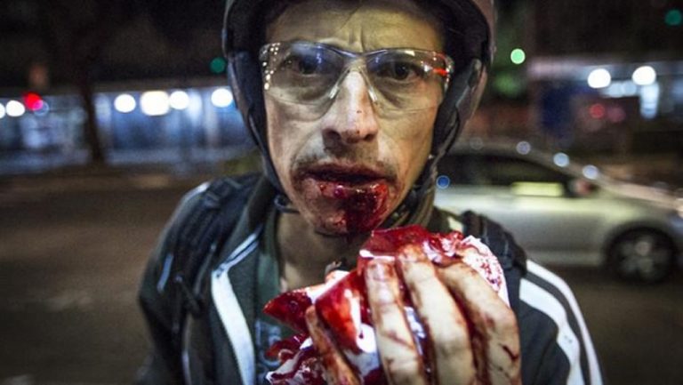 fotografo Fernando Fernandes, atingido por bala de borracha na boca foto Felipe Larozza